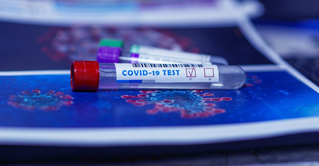 Positive covid test